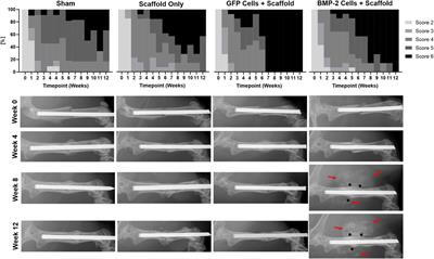 Cryogel Scaffold-Mediated Delivery of Adipose-Derived Stem Cells Promotes Healing in Murine Model of Atrophic Non-Union